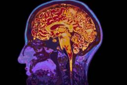 scan-of-a-brain-featured