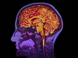 scan-of-a-brain-featured